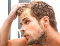 Dandruff Facts, Myth, And Major Understanding You Should Know