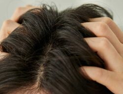 5 Severe Dandruff Causes And The Remedy To Know