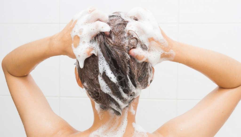 4 Must-Try Natural Severe Dandruff Removal to Get Rid of Dandruff