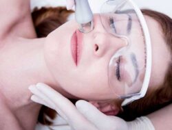 How Much Does Laser Acne Scar Removal Cost on Average?