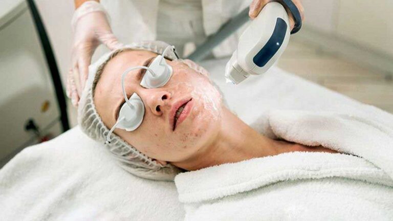 laser-therapy-for-atrophic-acne-scars-a-case-and-evidence-based