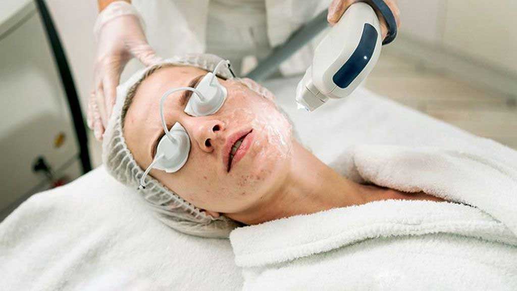 How Much Does Laser Acne Scar Removal Cost on Average?